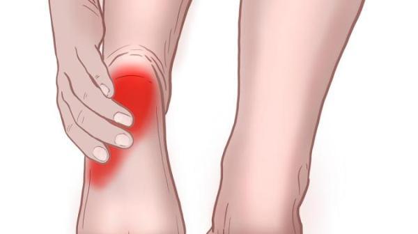 هرآنچه که باید راجع به خار پاشنه بدانیم هرآنچه که باید راجع به خار پاشنه بدانیم